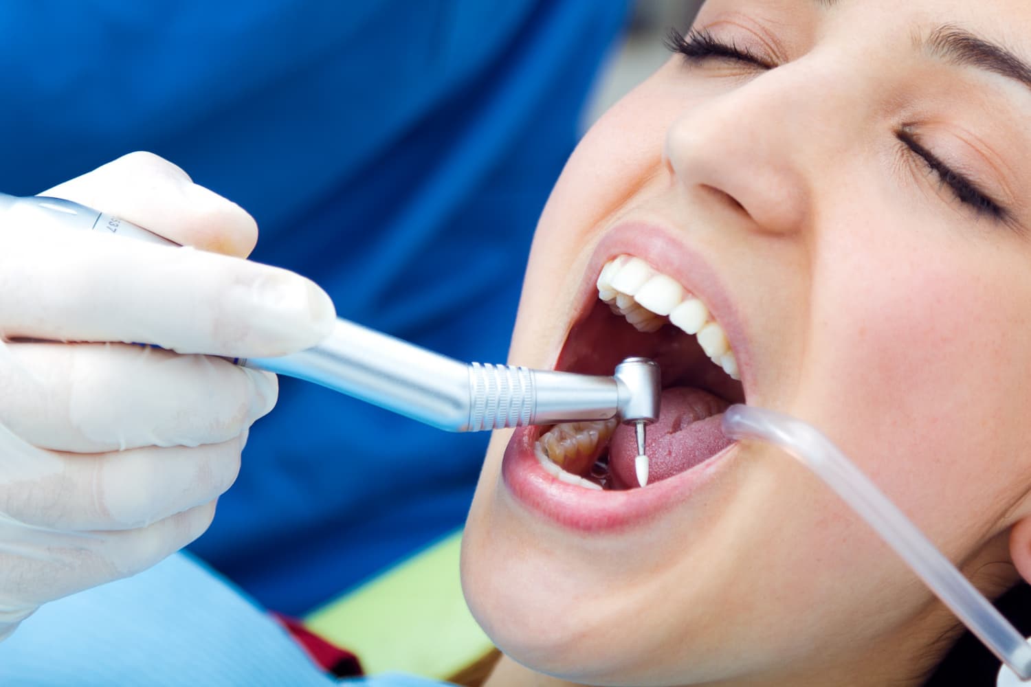 Micro-Endodontics (Root Canal Treatment)