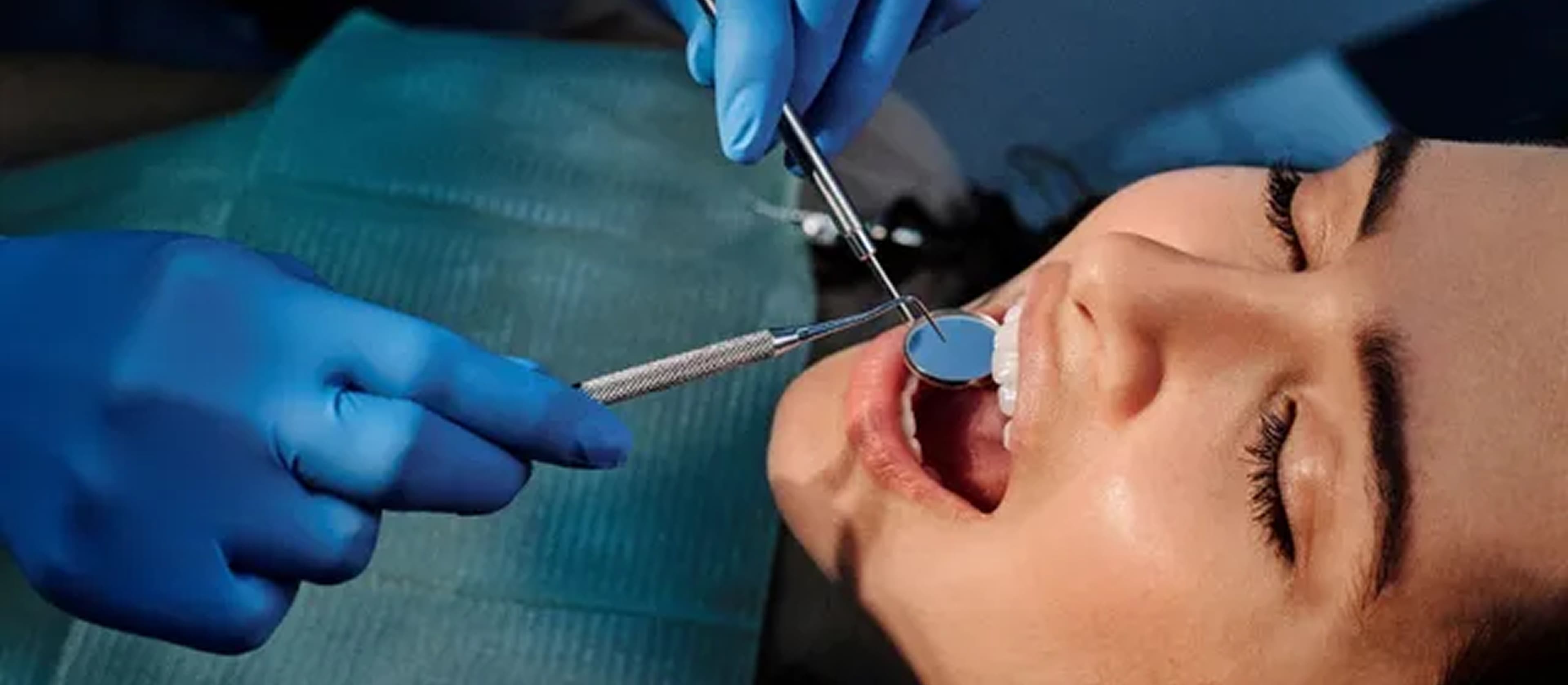 Common dental problems checkup