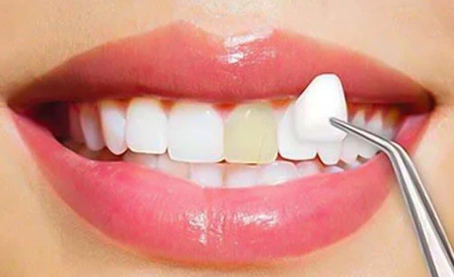 Common dental cosmetic issues