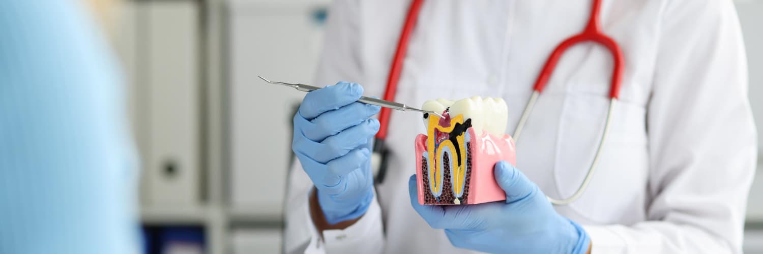 Root canal procedure model at DDS