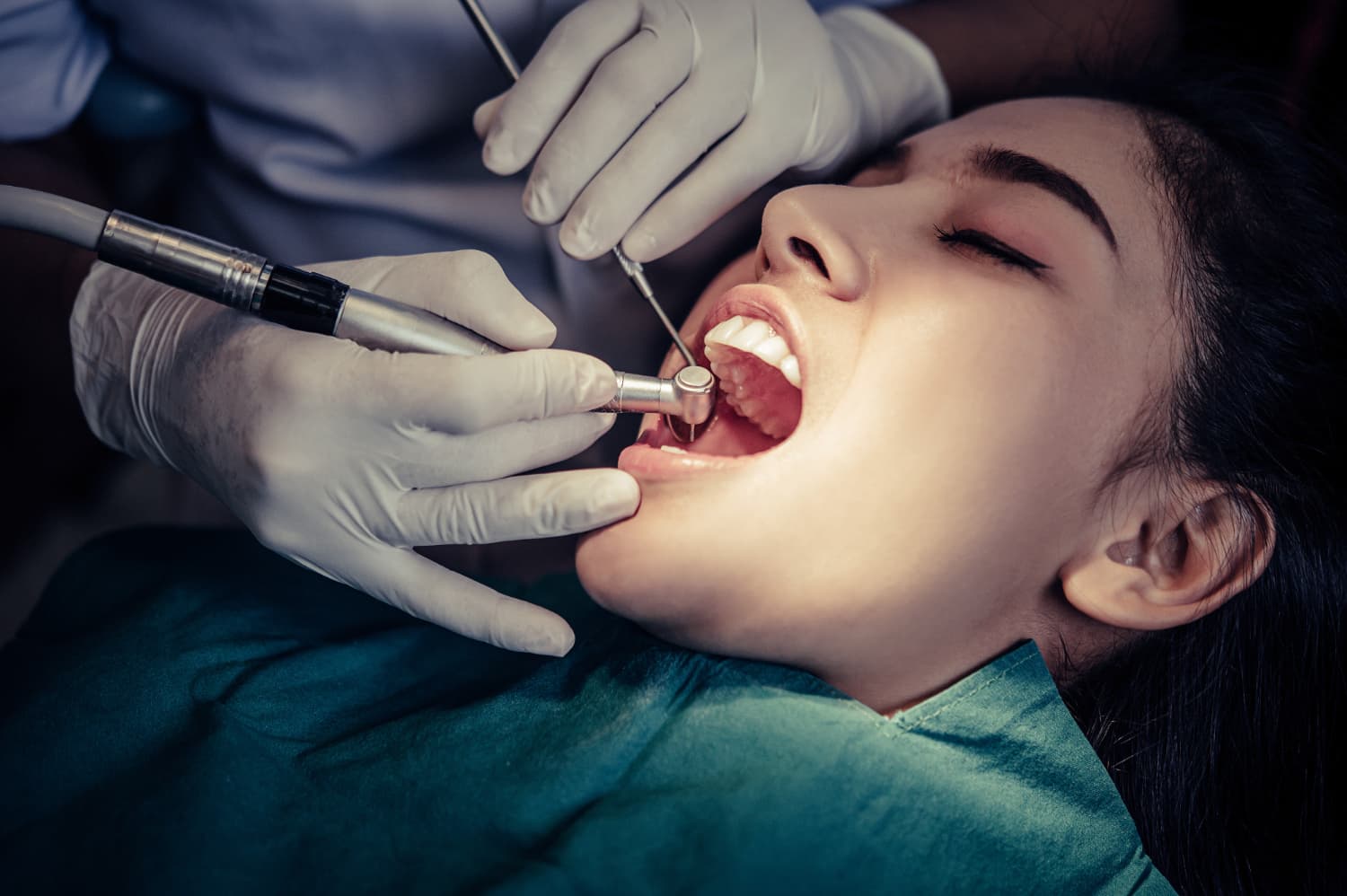 Dental implants consultation at DDS