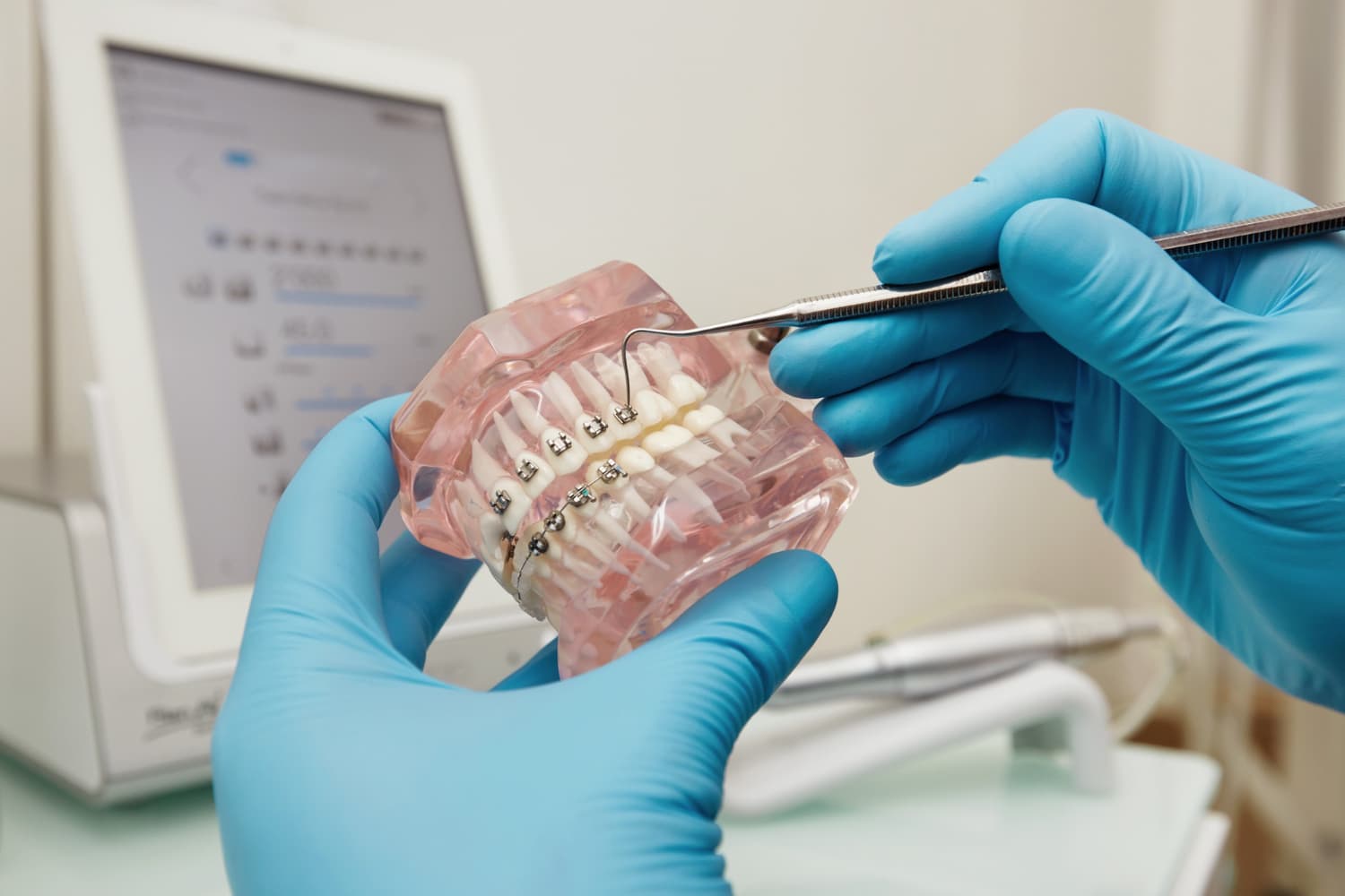 Orthodontic treatment models